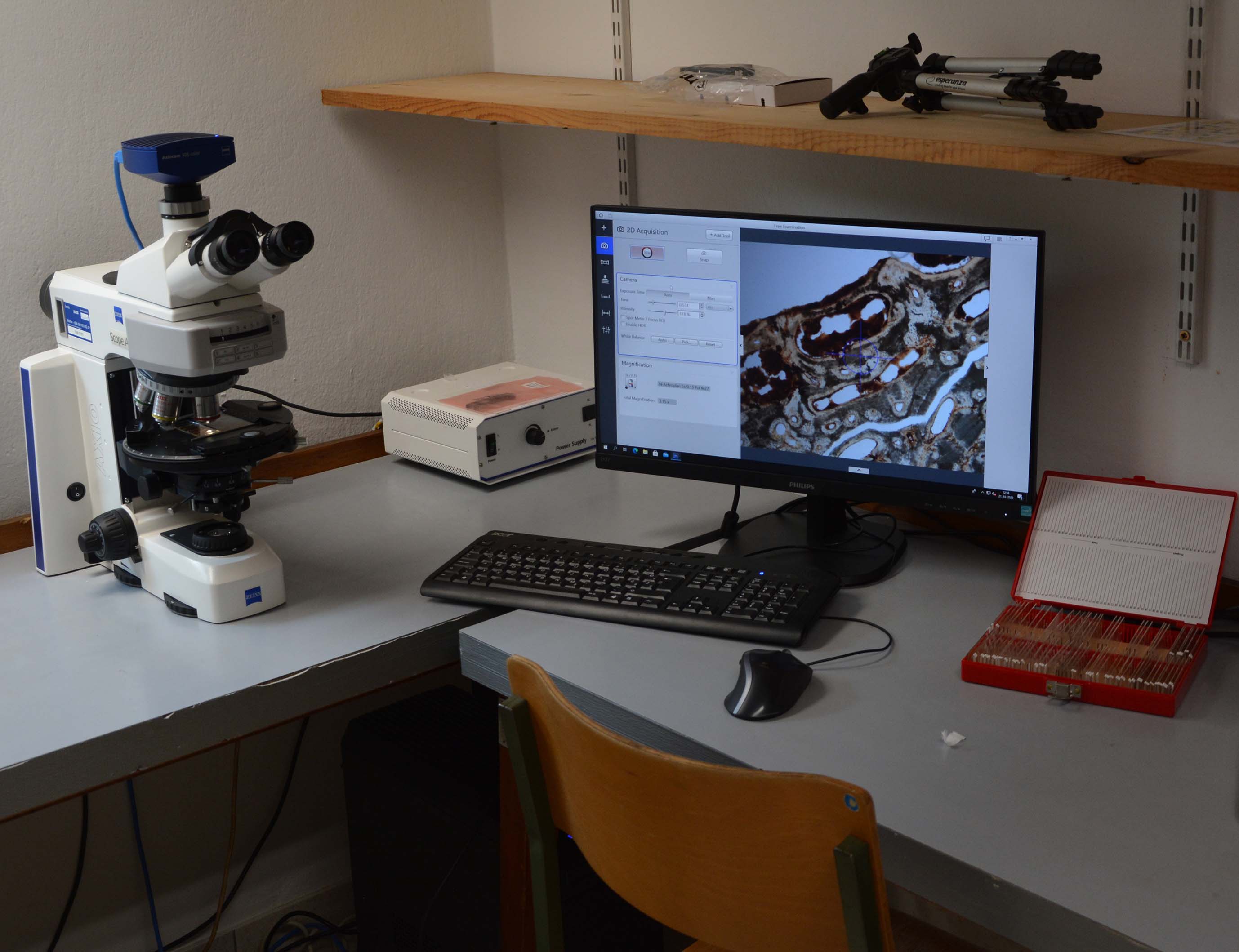 Histološka analiza zbruska kosti pod mikroskopom. 